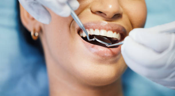 Best Emergency Root Canal Treatment in Golden Valley, MN